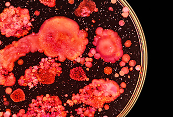 IrrE : une enzyme clé de la radiorésistance bactérienne