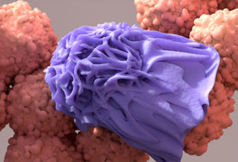 Une nouvelle thérapie cellulaire pour les cancers solides
